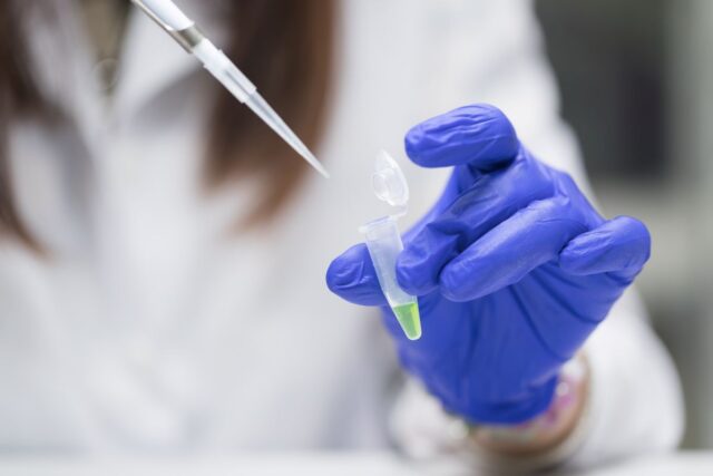 Lab technician adding liquid into a container